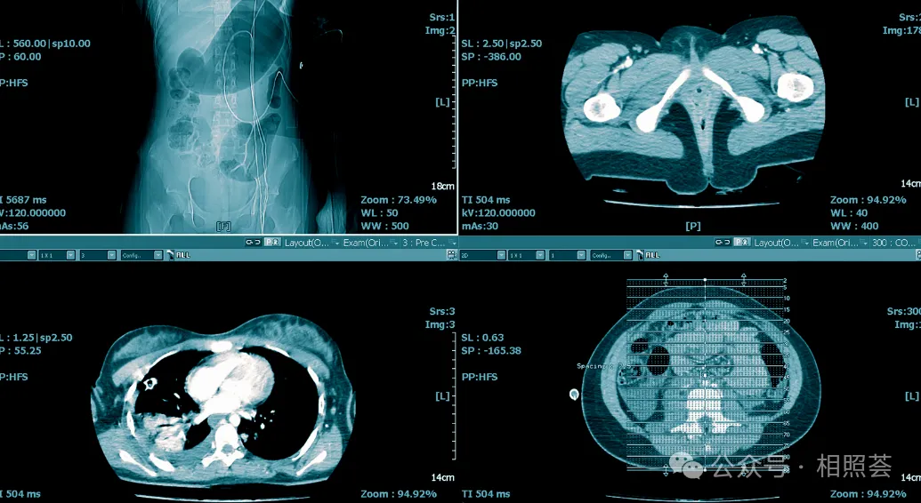 什么是DICOM格式医学影像？患者如何在家用电脑查看？