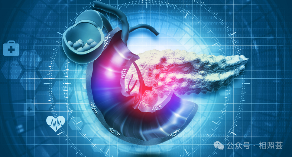 重症胰腺炎后肠瘘？内镜支架置入术避免“二次开刀”之苦！