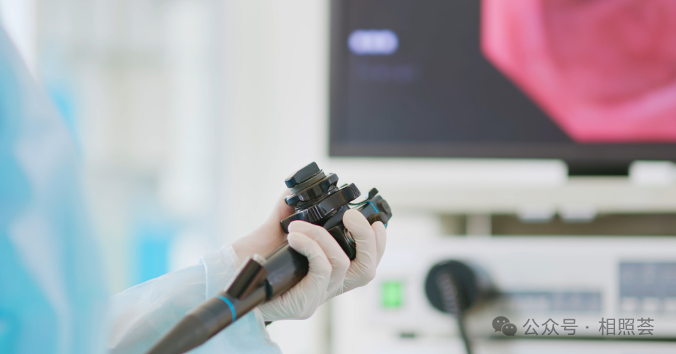 早发性“结直肠癌”偷袭年轻人，提前筛查是福是祸？