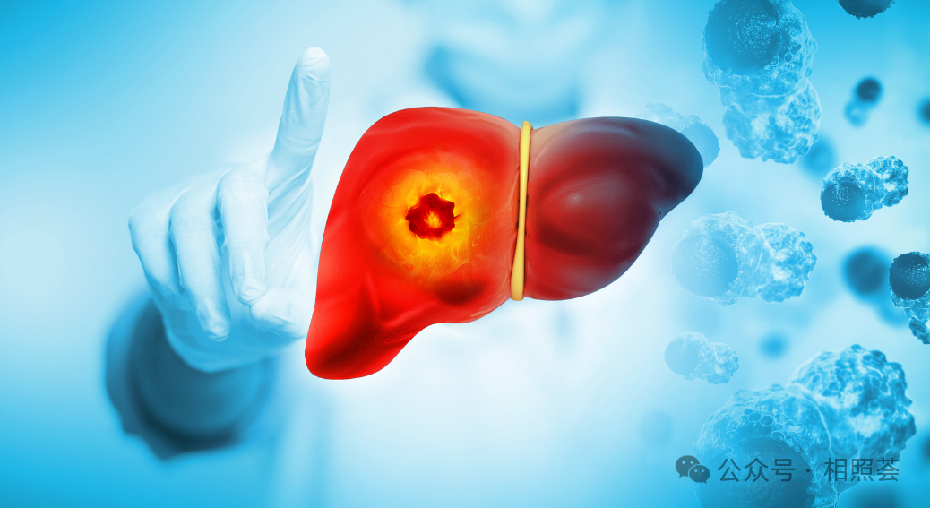 肝癌治疗&ldquo;黑科技&rdquo;：Tcm细胞技术如何突破传统局限？