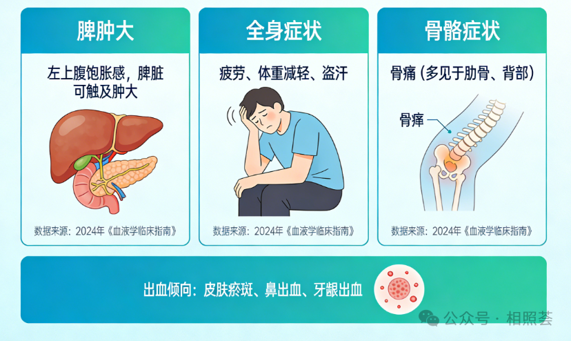 骨髓纤维化&ldquo;靶向新药&rdquo;：JAK2抑制剂+BET抑制剂联用，脾脏缩小率超65%！